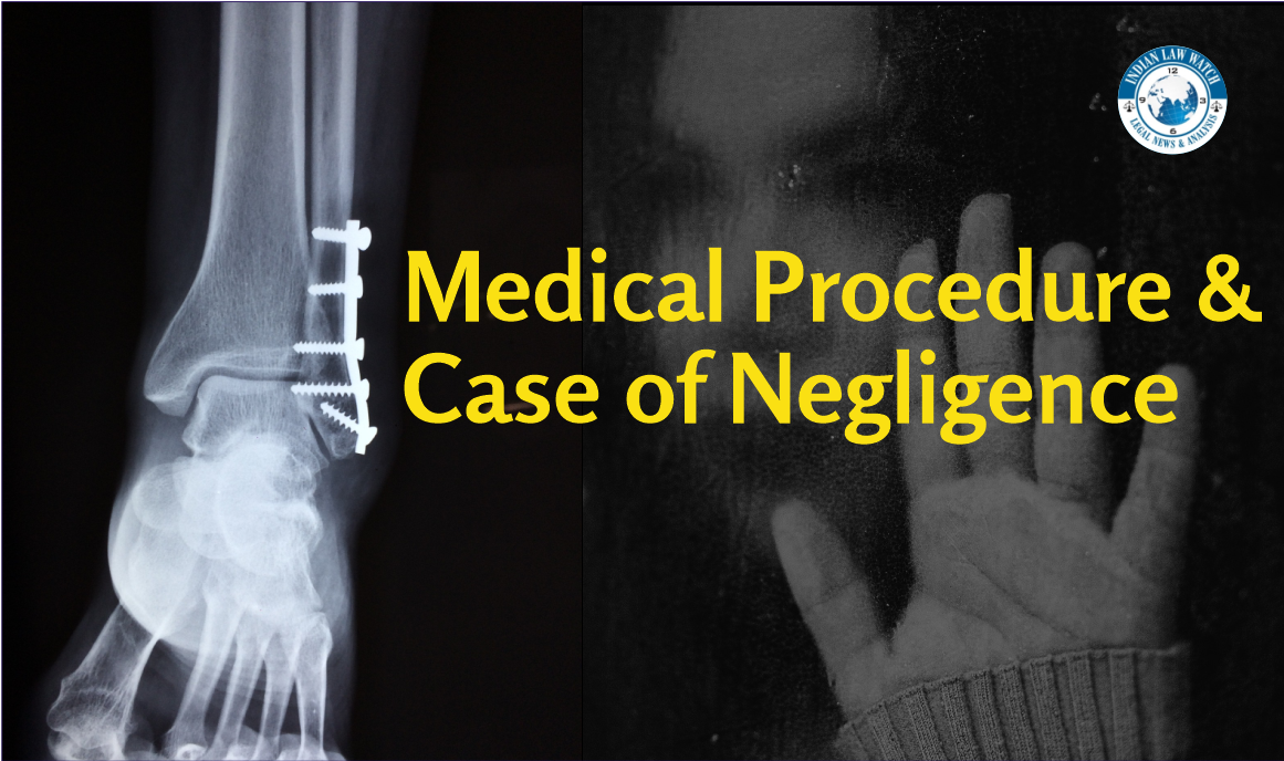negligence